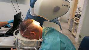 haartransplantation mit artas haar roboter haartransplantation haarausfall frauen haare