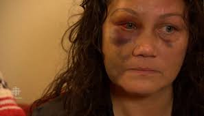 Winnipeg mom says she was beaten by police in front of son — then charged  with assault