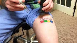 Once deep enough in the dermis to reach the unwanted tattoo ink, the laser's energy heats up and shatters the ink. Laser Tattoo Removal In Plymouth South Shore Ma Youtube
