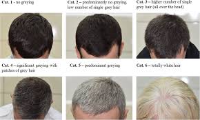 The reason these are so revered is their tight and secure fit, durability and facilitation of more precise, easier haircuts. Hair Greying 6 Stage Classification And Examples Download Scientific Diagram
