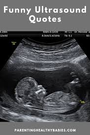 21 Funny Ultrasound Quotes Funny Quotes Funny Quotes