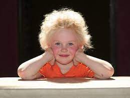 The man has blond hair. University Of Bonn Discover Three Mutations That Can Cause Uncombable Hair Syndrome Daily Mail Online