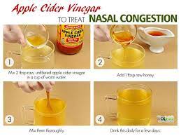 How To Clear Nasal Congestion 7 Home Remedies Apple Cider Vinegar Remedies Apple Cider Vinegar Drink Nasal Congestion