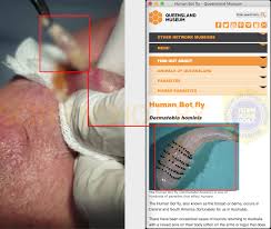 Ciri ciri terkena lalat botfly. Salah Video Cacing Datang Di Kaleng Turnbackhoax Id