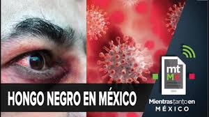 La mucormicosis, conocida como hongo negro se relaciona al alojamiento de un hongo en la cavidad nasal y se desarrolla en pacientes con alguna inmunodeficiencia. Hongo Negro En Mexico Que Es Sintomas Como Se Contagia Mientras Tanto En Mexico Youtube