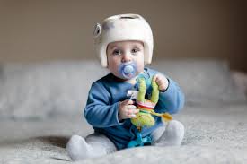 Helmtherapie Beim Baby Babyartikel De Magazin