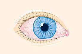 Maybe you would like to learn more about one of these? Ai Ochii RoÈ™ii IatÄƒ 7 Cauze Ale Ochiului RoÈ™u I Care