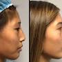Profile Picture of Boston MA Plastic Surgery | BBL, Breast Augmentation, Body ... (@backbayplasticsurgery.com) on Google