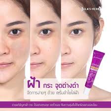 Longan Melasma Serum by Jula's Herb