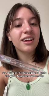 SugarBear Lash Serum Review and Results