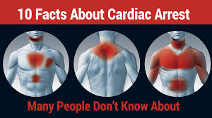 Sca usually causes death if it is not treated within minutes. 10 Facts About Cardiac Arrest Many People Don T Know About