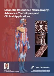 Exploration of Musculoskeletal Diseases