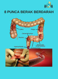Maybe you would like to learn more about one of these? Berak Berdarah Apa Harus Saya Wow Gum Arabic Sauda Facebook
