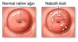 Pin Di Obat Herbal