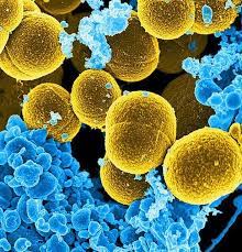 Hier eine übersicht über die häufigsten resistenten keime und was bei einer infektion mit einem solchen. Haufiger Mrsa Keim Stammt Aus Europa Weltweit Verbreitete Variante Des Resistenten Erregers Geht Auf Europaischen Vorfahren Zuruck Scinexx De