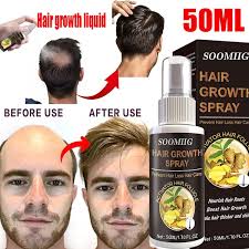 It improves hair appearance by making it. Ginger Hair Growth Essence Natural Beauty Hair Spray Hair Growth Essence Oil 10 20 30 50ml Wish