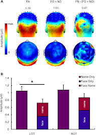 Investment, market cap and category. Neurophysiological Evidence For Crossmodal Face Name Person Identity Representation In The Human Left Ventral Temporal Cortex