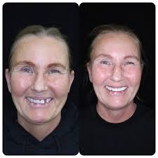 Ash Gill (@dentalestheticstudio) • Instagram photos and videos