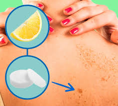 Dark spots are the most awkward stuff for everyone. 11 Ways To Remove Dark Spots From Your Skin