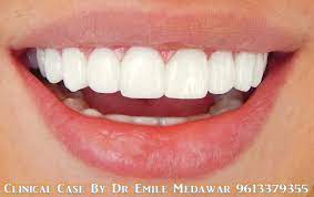 pin on teeth