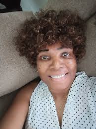 What causes moles and skin tags?