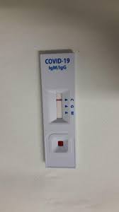 Coleta por saliva, para detecção do vírus à partir do 1º dia de sintoma. Coronavirus A Cada 100 Testes De Farmacia Para Covid 19 15 Dao Positivo No Brasil
