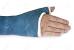 Spiderman Arm Cast