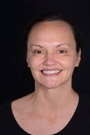 Information for Patients