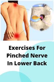 Pin On Sciatica