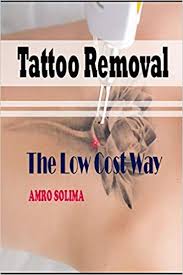 There are many methods of tattoo removal that are available today. Buy Tattoo Removal The Low Cost Way Book Online At Low Prices In India Tattoo Removal The Low Cost Way Reviews Ratings Amazon In