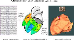 Polygon fill the polygon fill allows to select polygons on the 3d mesh to create masks base don the. Prospective Assessment Of An Automated Intraprocedural 12 Lead Ecg Based System For Localization Of Early Left Ventricular Activation Circulation Arrhythmia And Electrophysiology