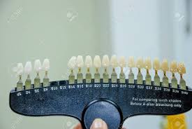 Dentist Checking And Selecting Color Of Young Mans Teeth Closeup