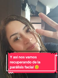 Recuperación de la parálisis facial con paciencia y actitud