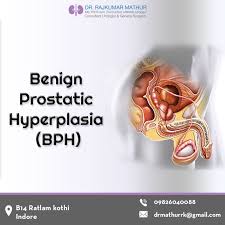 Benign Prostatic Hyperplasia Bph Benign Prostatic Hyperplasia Urologists Enlarged Prostate