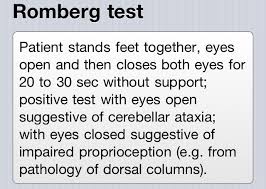 Image result for Romberg Test
