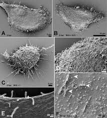 We did not find results for: Ultrastructural Analysis Of Sars Cov 2 Interactions With The Host Cell Via High Resolution Scanning Electron Microscopy Scientific Reports