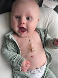 Someone is super happy to be home 🥰 Ava got discharged from the hospital  yesterday and has been smiling all day long. Thanks again for all the  prayers!