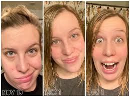 💦 I switched this ONE thing in my skincare routine and my skin stopped  freaking out… Total game changer. 🔗👇🏻