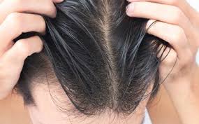 Using the best vitamins for hair growth may not give you the most luxurious and most bouncy mane, but it will provide you with healthy hair. 5 Best Vitamins For Hair Growth Watsons Health