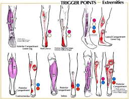 Pin On Trigger Points