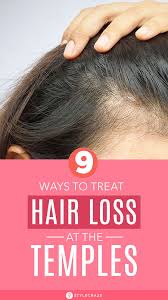 Hair loss on the temples can be due to a lack of protein, or a deficiency in certain vitamins and minerals. 8 Simple Ways To Treat Hair Loss At The Temples Emple Hair Loss In Females Is Common And Dealing With It Can Be Qui Treat Hair Loss Temple Hair Loss Hair Loss