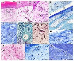 Sun exposure and having a weak immune system can affect the risk of merkel cell carcinoma. A Comparative Analysis Of The Organization Of The Sensory Units In The Beak Of Duck And Quail
