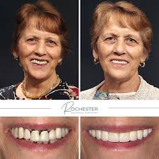 Step into a dental experience that puts your comfort first. At Rochester  Advanced Dentistry, we go beyond the standard of care to provide  personalized, advanced, and comprehensive treatment in a relaxing  environment.