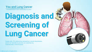 Lung cancer (cancer of the lung) is common worldwide. Slide Show Diagnosis And Screening Of Lung Cancer