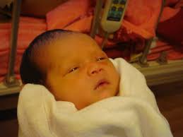 Meskipun penyakit kuning umum terjadi pada bayi baru lahir, kadar bilirubin yang tinggi dan tidak ditangani (secara medis dikenal sebagai hiperbilirubinemia berat) dalam darah dapat menyebabkan bilirubin mengalir ke dalam otak sehingga mengakibatkan komplikasi yang serius. Penyebab Penyakit Kuning Pada Bayi Baru Lahir
