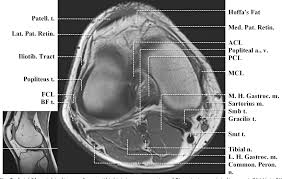 They are attached to the femur (thighbone), tibia (shinbone), and fibula (calf bone) by fibrous tissues called ligaments. Figure 3 From Normal Mr Imaging Anatomy Of The Knee Semantic Scholar