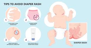 Image result for sweat rash on back baby
