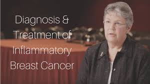 Unlike other breast cancers, this type of cancer may not cause a lump in the breast. Diagnosis And Treatment Of Inflammatory Breast Cancer Youtube