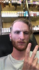 Young adult experiencing balding spot