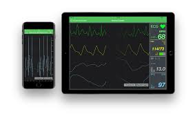 Scichart Wpf Charts Ios Charts Android Charts And